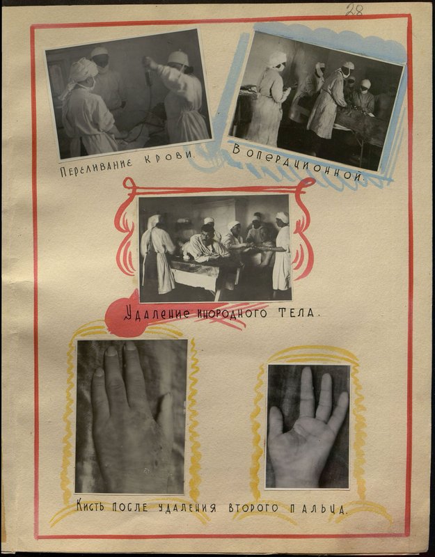 Original image: Brush after removing the second toe