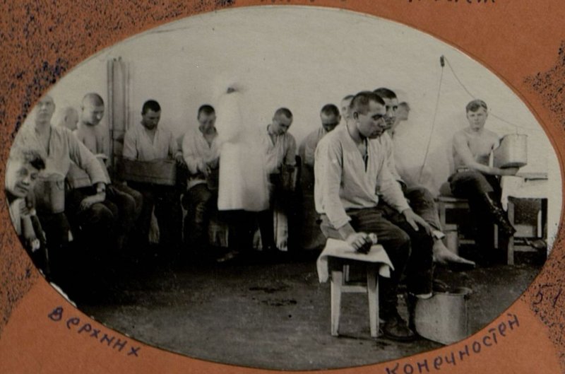 Image: Upper limb baths