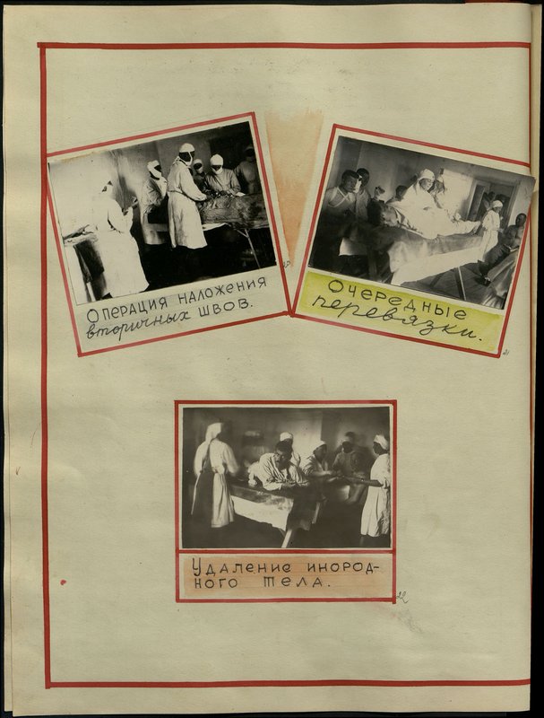 Original image: Removal of a foreign body