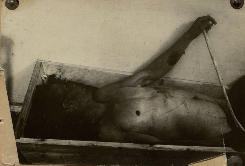 Фотография: На снимке показана рана товарища Колесникова на руке с последующим выходом в сердце