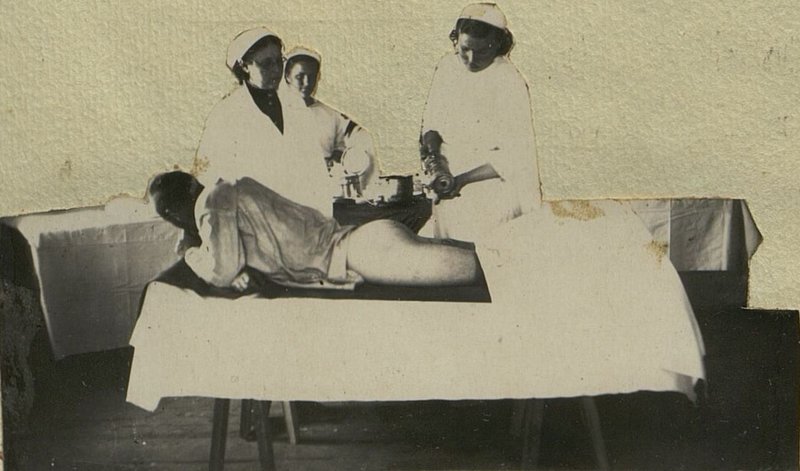 Image: Applying paraffin to the wound using a spray bottle
