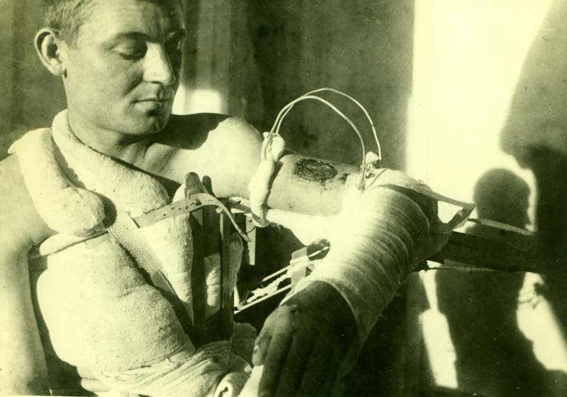 Treatment of wounds in an open way. E/g No. 2133