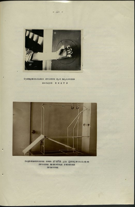Original image: Functional treatment for finger injuries