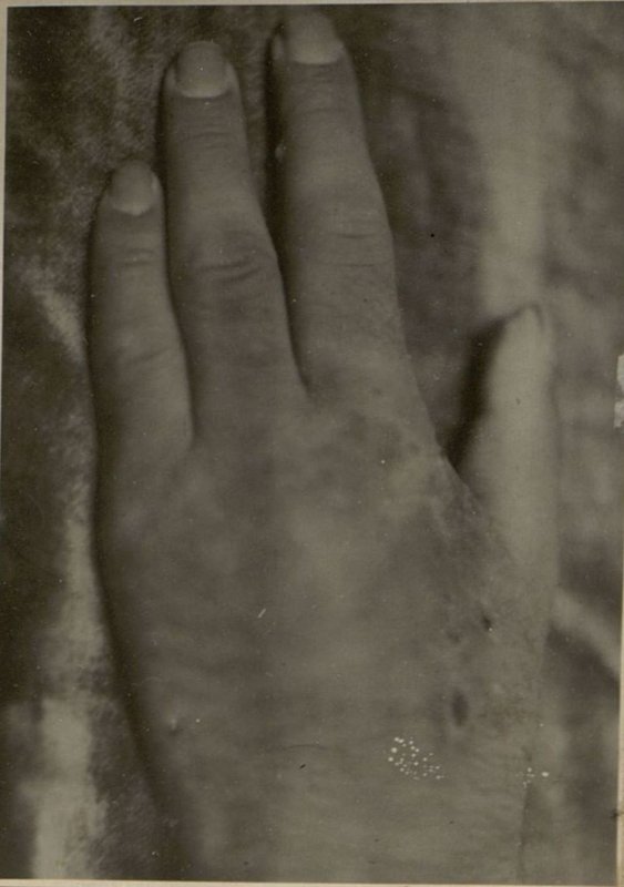 Image: Brush after removing the second toe