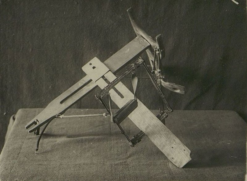 Image: Modified NIISI splint for treating shoulder fracture